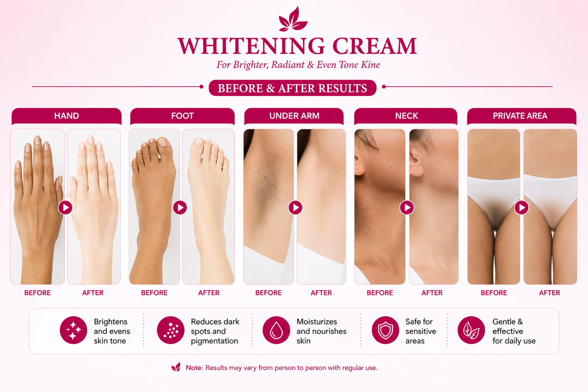 Whitening Cream