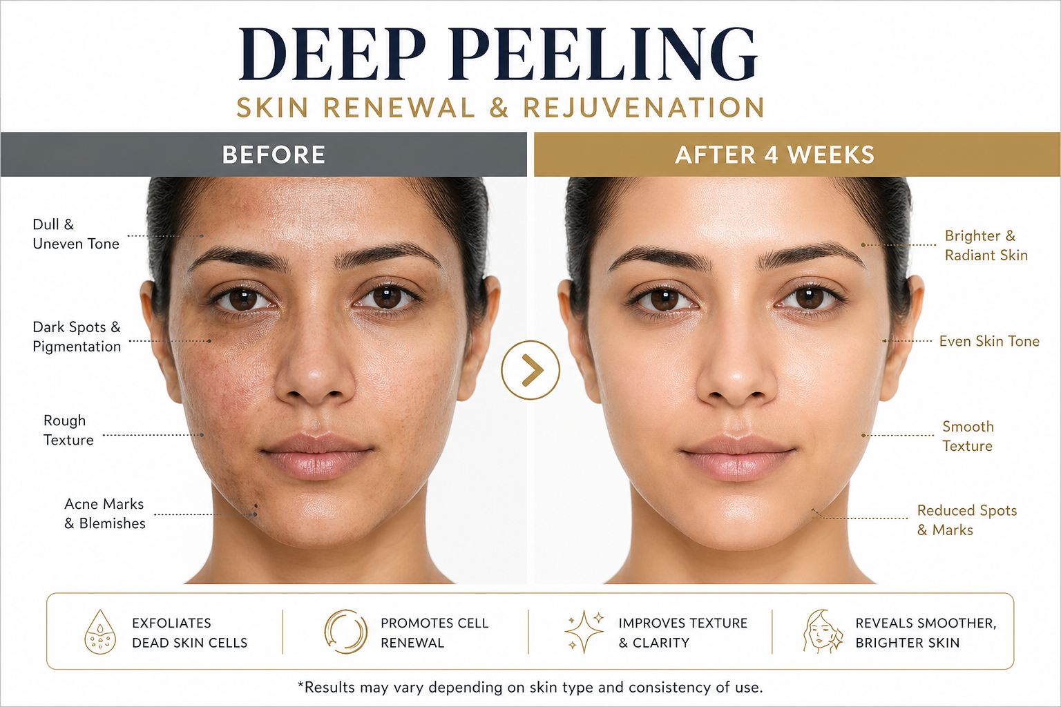 Deep Peeling Serum AHA+BHA