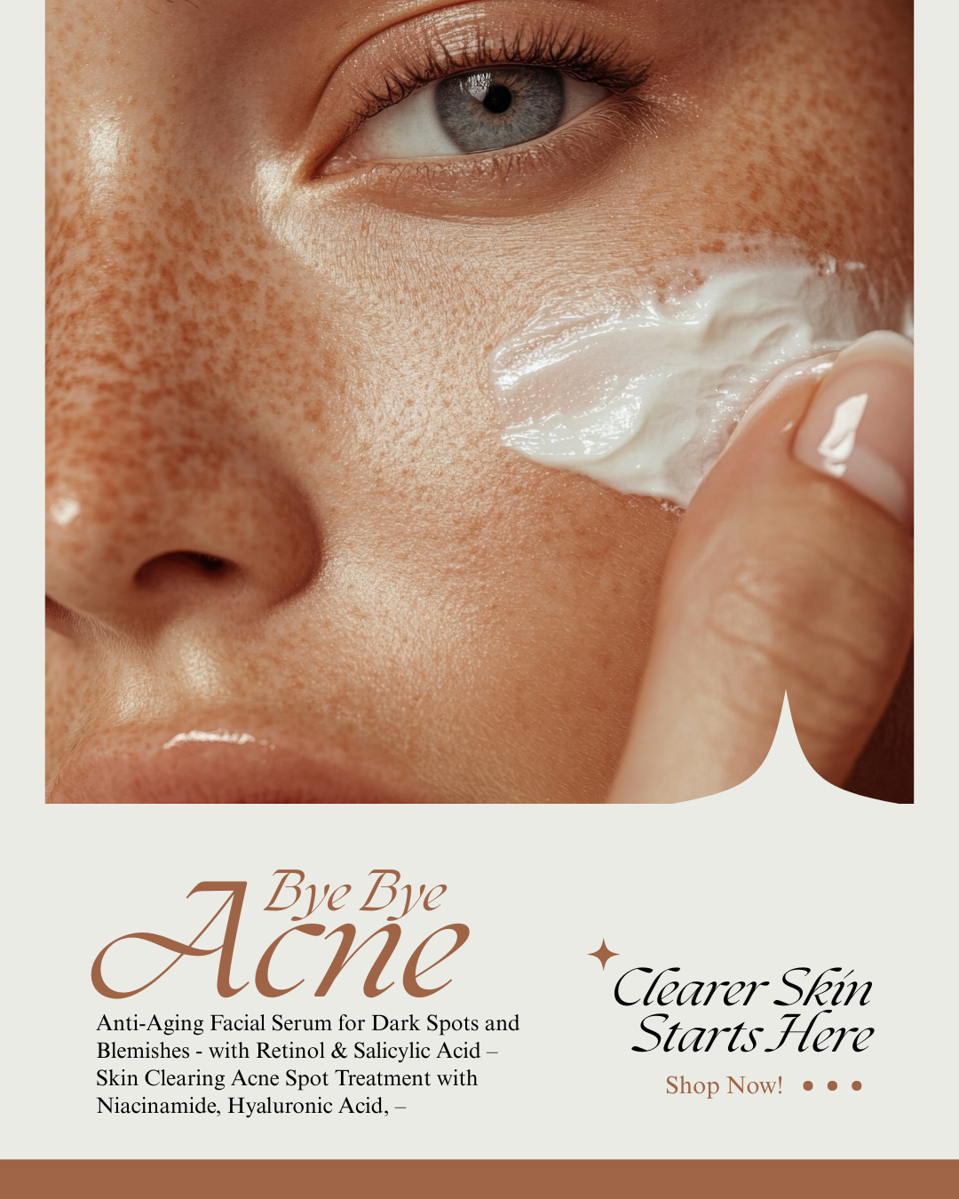 Anti-Acne Facial Serum for Dark Spots